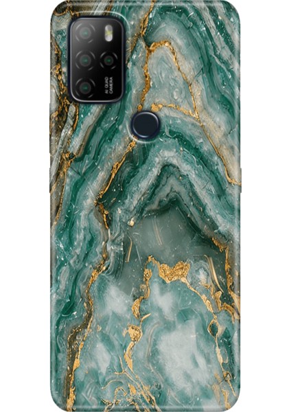 Omix X300 / Omix X500 Kılıf Hd Silikon Granit