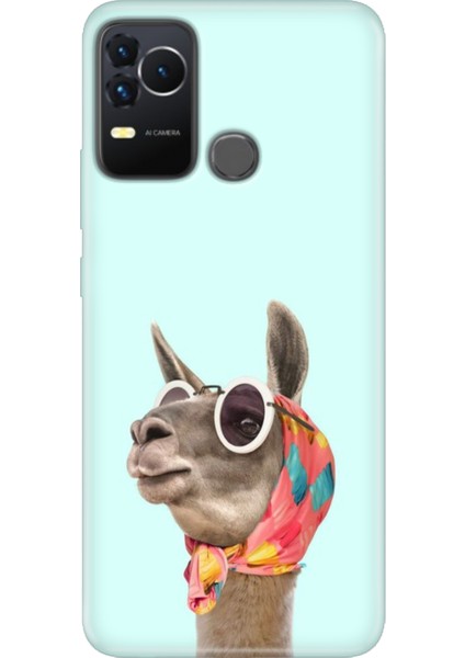 Omix X400 Kılıf Renkli Esnek Silikon Deve