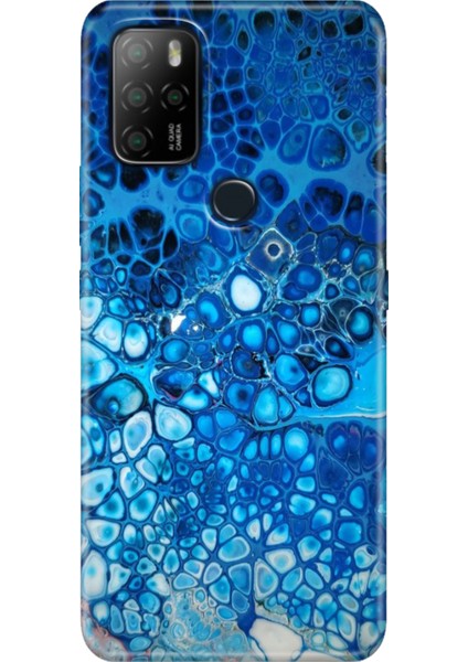 Omix X300 / Omix X500 Kılıf Hd Silikon Derin Mavi