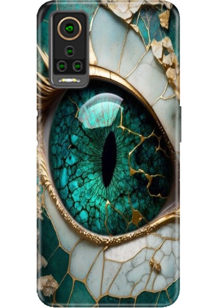 General Mobile Gm 22 Pro Kılıf Hd Desenli Esnek Silikon Tanrıça Gözü