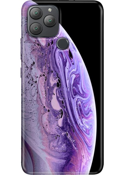 General Mobile Gm 22 Plus Kılıf Desenli Esnek Silikon Uv World