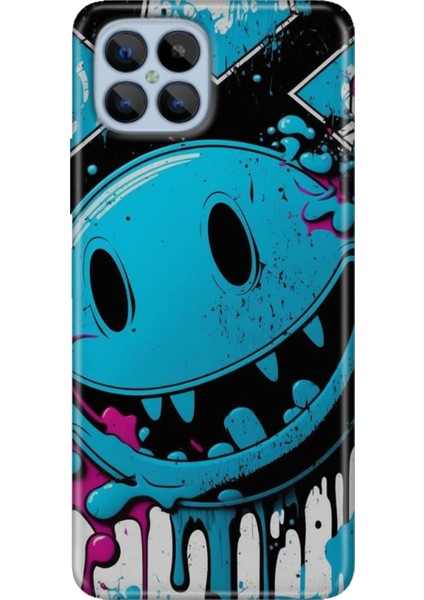 Omix X600 Kılıf Renkli Esnek Silikon Vintage Wall