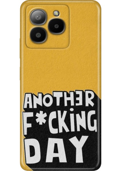 Omix X7 Kılıf Silikon Tasarım Stok Another