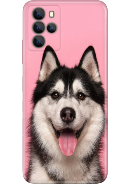 Omix X700 Kılıf Hd Silikon Hasky