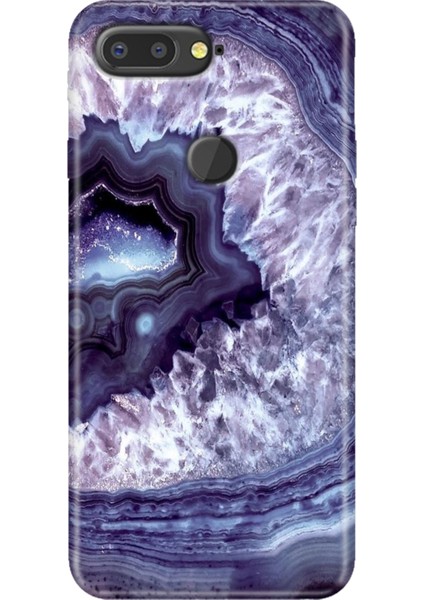 General Mobile Gm 9 Pro Kılıf Desenli Esnek Silikon Kapak Uv Elmas