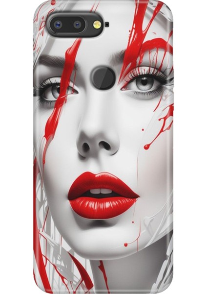 General Mobile Gm 9 Pro Kılıf Desenli Esnek Silikon Kapak Uv Lady