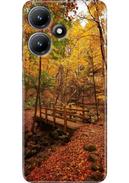 Infinix Hot 30 Kılıf Baskılı Esnek Silikon Kapak Kasımda Aşk