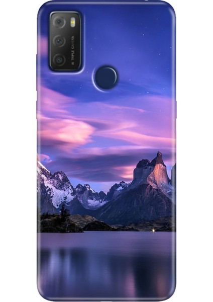 Tcl 20E Kılıf Desenli Silikon Kampanyalı Kapak Kuzey