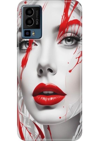 General Mobile Gm 23 Kılıf Desenli GM23 Silikon Case Uv Lady