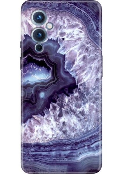 Oneplus 9 Kılıf Desenli Silikon Renkli Tpu Uv Elmas