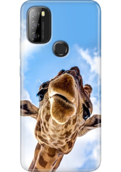 Reeder P13 Blue Max 2021 Kılıf Rubber Baskı Silikon Cover Öpücük