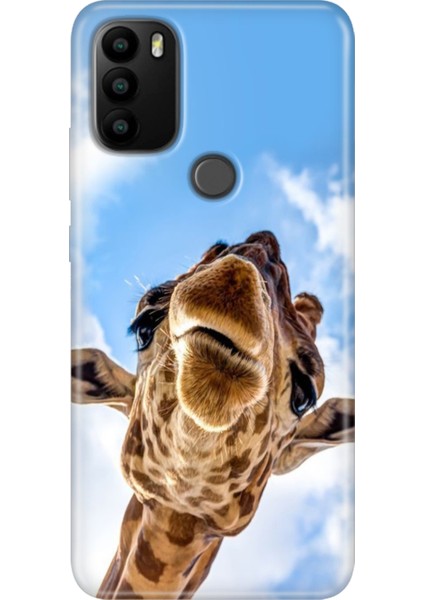 General Mobile Gm 21 Pro Kılıf Baskılı Esnek Silikon Kapak Öpücük