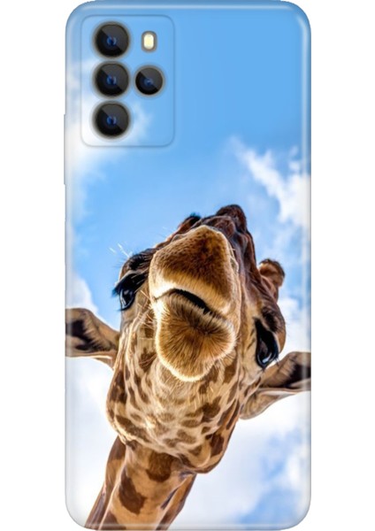 Omix X700 Kılıf Hd Silikon Öpücük