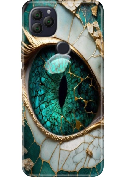 General Mobile Gm 22 - 22S Kılıf Desenli Rubber Silikon Tanrıça Gözü