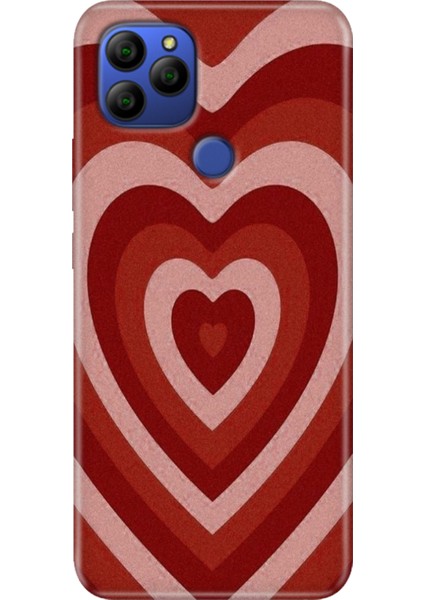 General Mobile Gm 21 Kılıf Baskılı Silikon Case Uv Mat Kalp