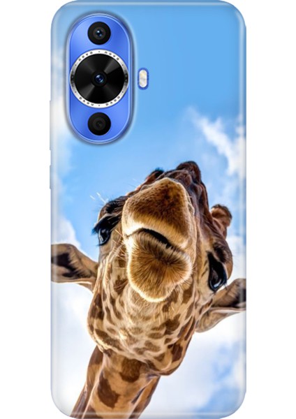Huawei Nova 12S Kılıf Desenli Kapak Renkli Tpu Uv Öpücük