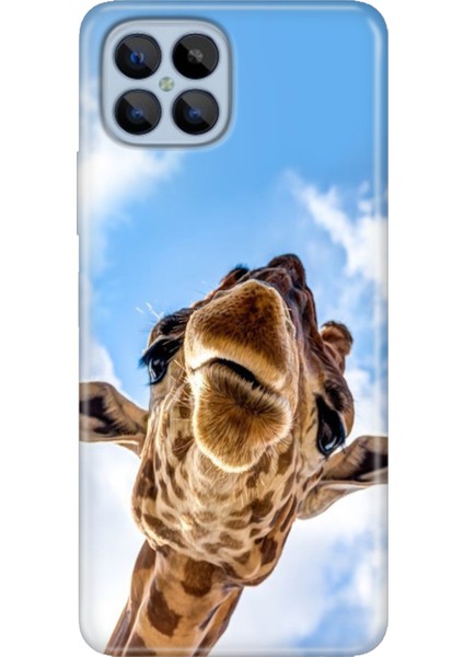 Omix X600 Kılıf Renkli Esnek Silikon Öpücük