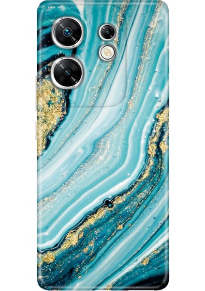 Infınıx Zero 30 4g Kılıf Hd Desenli Esnek Silikon Simli Taş