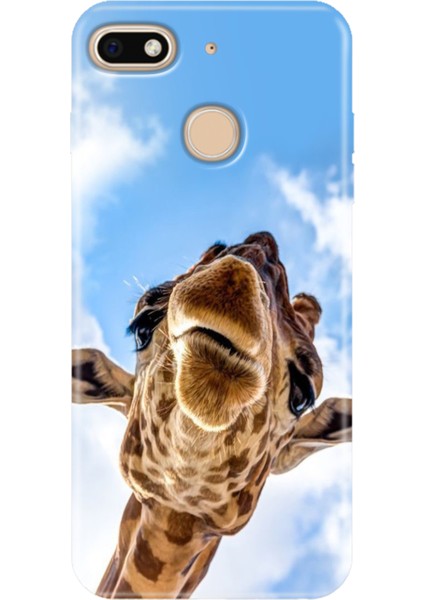 General Mobile Gm 8 Go Kılıf Desenli Silikon Renkli Tpu Uv Öpücük