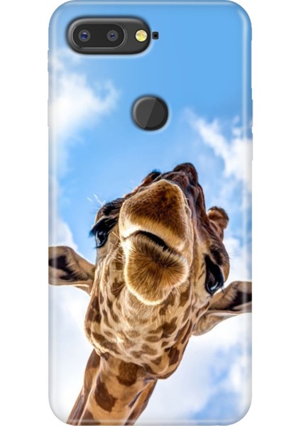 General Mobile Gm 9 Pro Kılıf Desenli Esnek Silikon Kapak Uv Öpücük