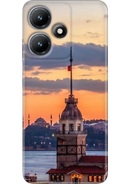 Infinix Hot 30 Kılıf Baskılı Esnek Silikon Kapak Kız Kulesi