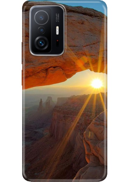 Xiaomi Mi 11T - 11T Pro Kılıf Desenli Design Silikon Sun