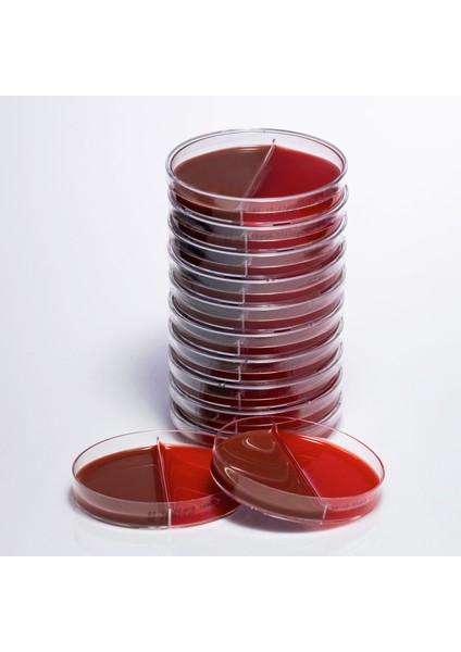 Hazır Koyun Kanlı + Çikolata Besiyeri - 1 Paket (10 Adet)