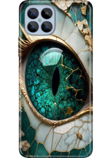 Omix X600 Kılıf Renkli Esnek Silikon Tanrıça Gözü