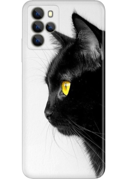 Omix X700 Kılıf Hd Silikon Kedi Bakışı