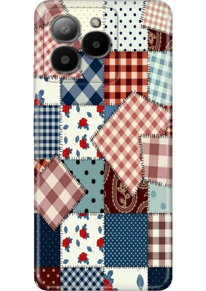 Omix X7 Kılıf Silikon Tasarım Stok Yama