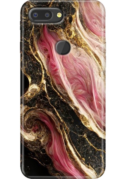 General Mobile Gm 9 Pro Kılıf Desenli Esnek Silikon Kapak Uv Seattle Mermer