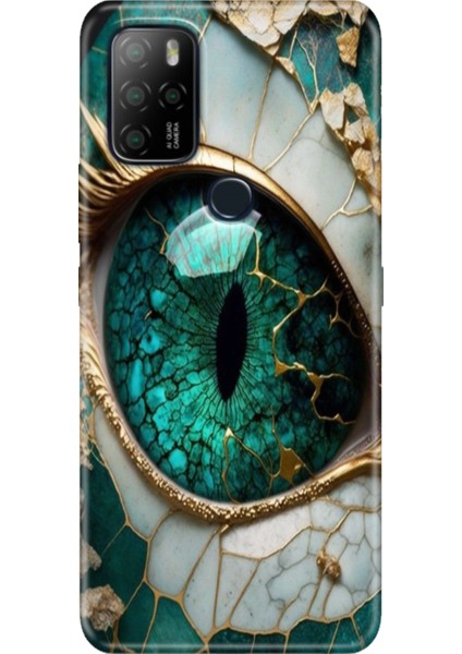 Omix X300 / Omix X500 Kılıf Hd Silikon Tanrıça Gözü