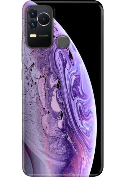 Omix X400 Kılıf Renkli Esnek Silikon World