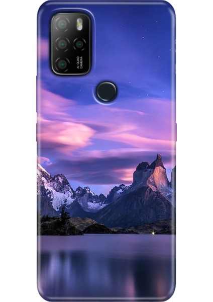 Omix X300 / Omix X500 Kılıf Hd Silikon Kuzey