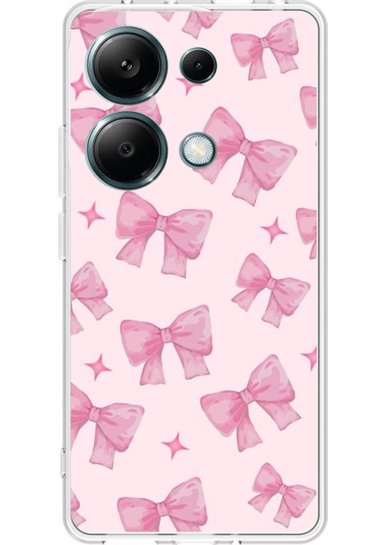 Redmi Note 13 Pro 4g Uyumlu Pembe Fiyonklar Baskılı Silikon Kılıf