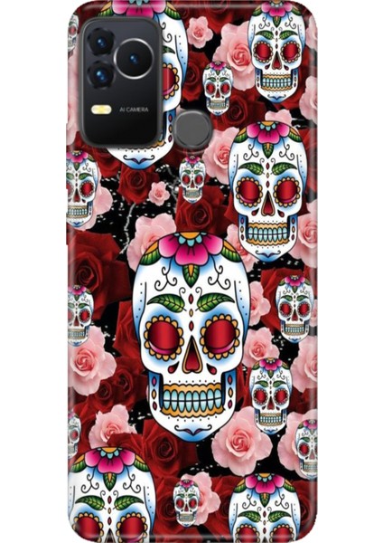 Omix X400 Kılıf Renkli Esnek Silikon Kabile