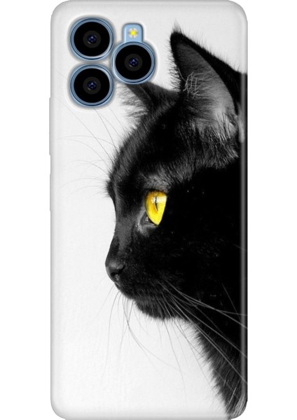 Omix X6 Kılıf Silikon Özel Kapak Kedi Bakışı