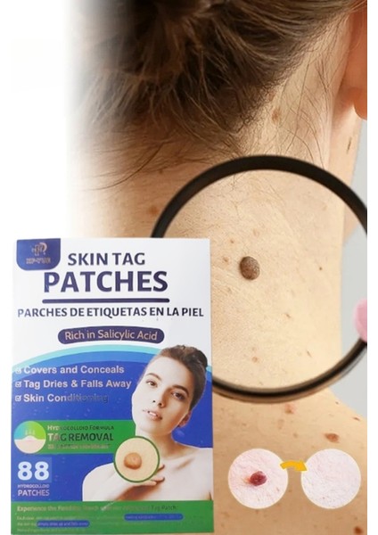 Skin Tag Remover 88 Adet Leke Karşıtı Dökücü Yokedici Bant Sıgıl Et Beni Giderici