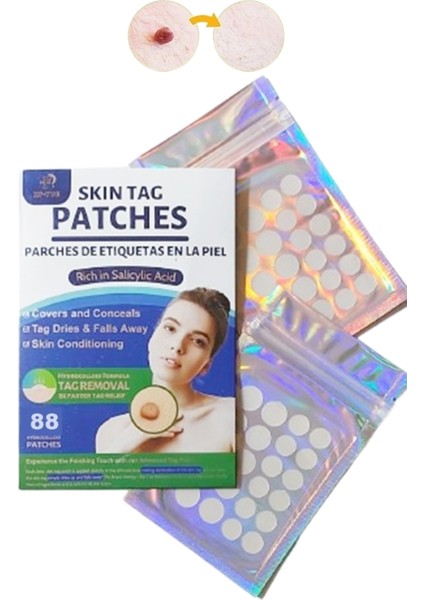 Skin Tag Remover 88 Adet Leke Karşıtı Dökücü Yokedici Bant Sıgıl Et Beni Giderici fırsatları