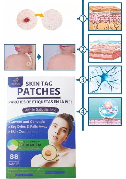 Skin Tag Remover 88 Adet Leke Karşıtı Dökücü Yokedici Bant Sıgıl Et Beni Giderici indirimleri