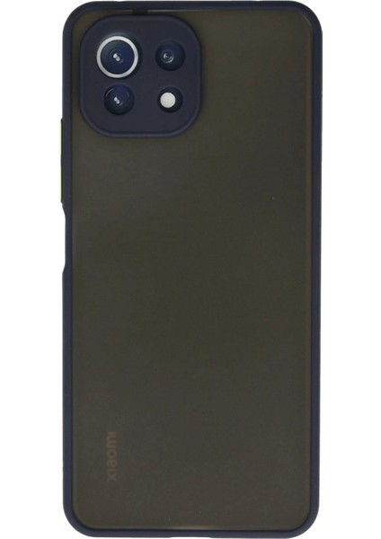 Xiaomi Mi 11 Lite Kılıf Montreal Silikon Kapak - Lacivert