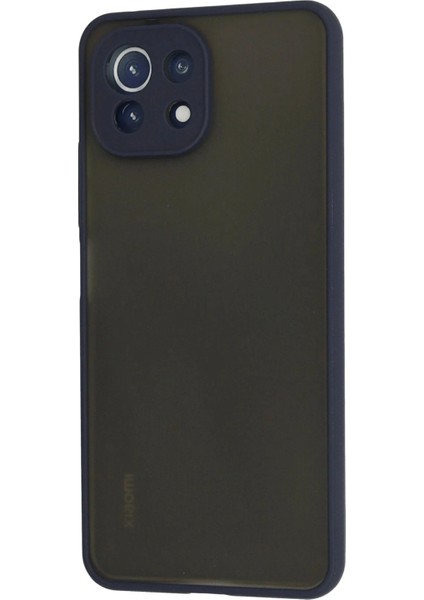 Xiaomi Mi 11 Lite Kılıf Montreal Silikon Kapak - Lacivert modelleri