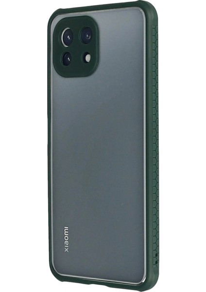 Xiaomi Mi 11 Lite Kılıf Miami Şeffaf Silikon - Koyu Yeşil modelleri