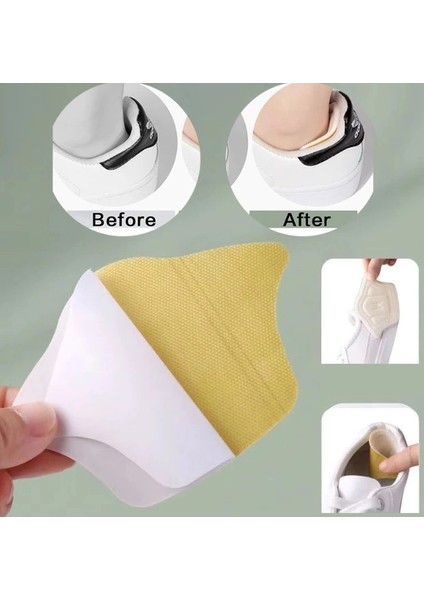 Buğz Taç Şeklinde Topuk Vurma Önleyici 10 Mm.