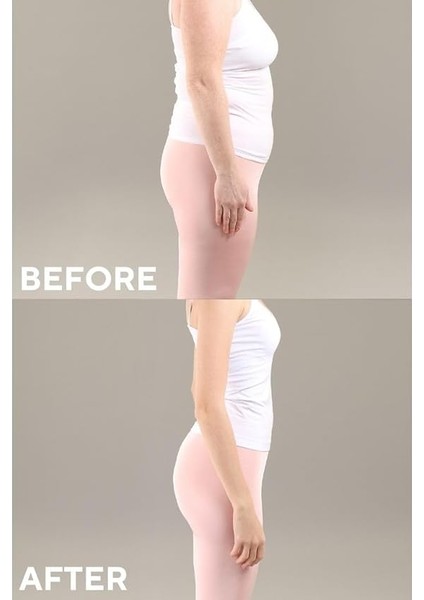 Ceel Selülit ve Çatlak Karşıtı Bölgesel Incelme ve Sıkılaştırıcı Jel (Soğuk Lipoliz) 250 ml indirimleri