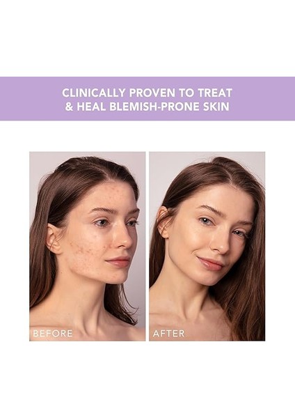 Espada 2 Plus Hassas Hedefleme Leke Karşıtı Cihaz - Leke Tedavisi Için Cilt Bakım Cihazı - Tıbbi Sınıf Silikon - Yüz Için Leke Tedavisi - Berrak Cilt indirimleri