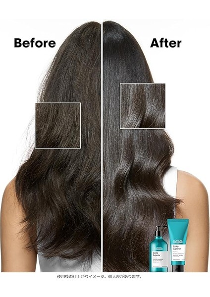 Professionnel Paris Serie Expert Scalp Advanced Hassas Saç Derisi Için Profesyonel Şampuan 500ML modelleri