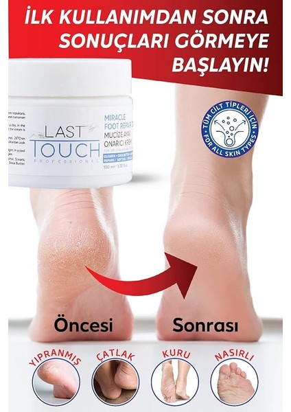 Touch Çatlak Onarıcı Mucize Ayak Bakım Kremi 100 ml (Vazelin & Shea Butter) modelleri