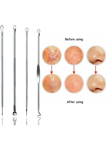 Nokta Akne Temizleyici 4'lü Kutulu Paslanmaz Komedon Gümüş Komedon Seti Sivilce Siyah Nokta Çıkarıcı Kaliteli fiyatları