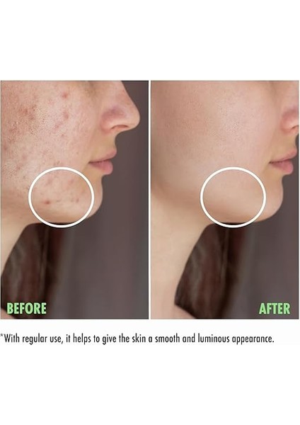 Karma ve Yağlı Ciltler Için Yüz Yıkama Jeli 200 ml modelleri